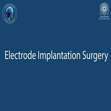 Electrode implantation surgery in the brain to treat drug-resistant epilepsy for the first time in the country